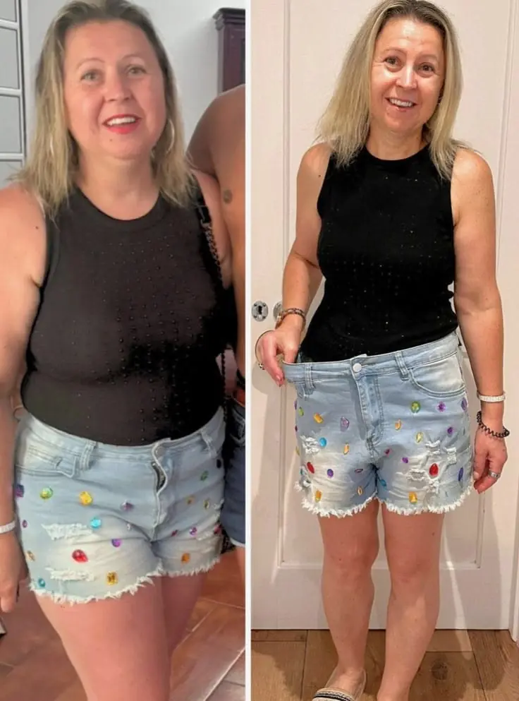 Antes e depois - Maria