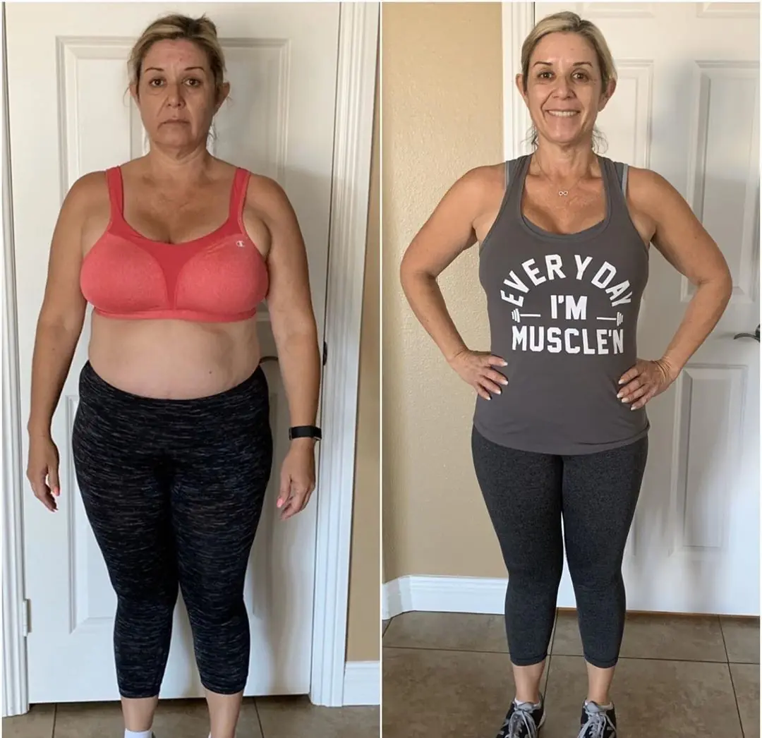 Antes e depois - Rosana