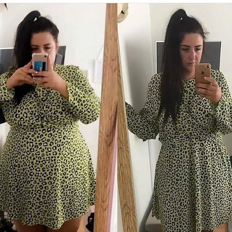 Antes e depois - Fernanda